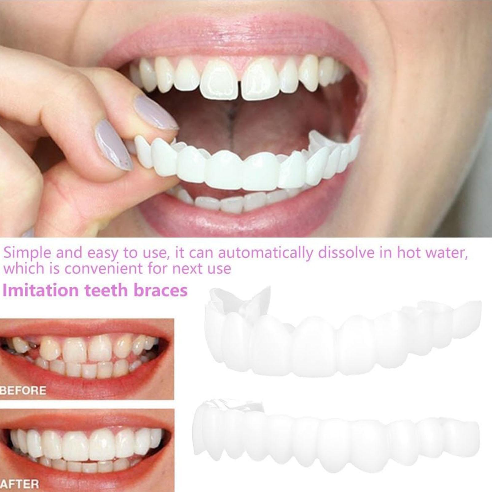 Teeth Whitening Mask - 2 шт., виниры для временных зубов