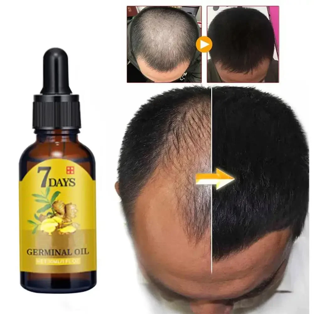 Coconut Oil Pull - Имбир для роста волос, эфирное масло