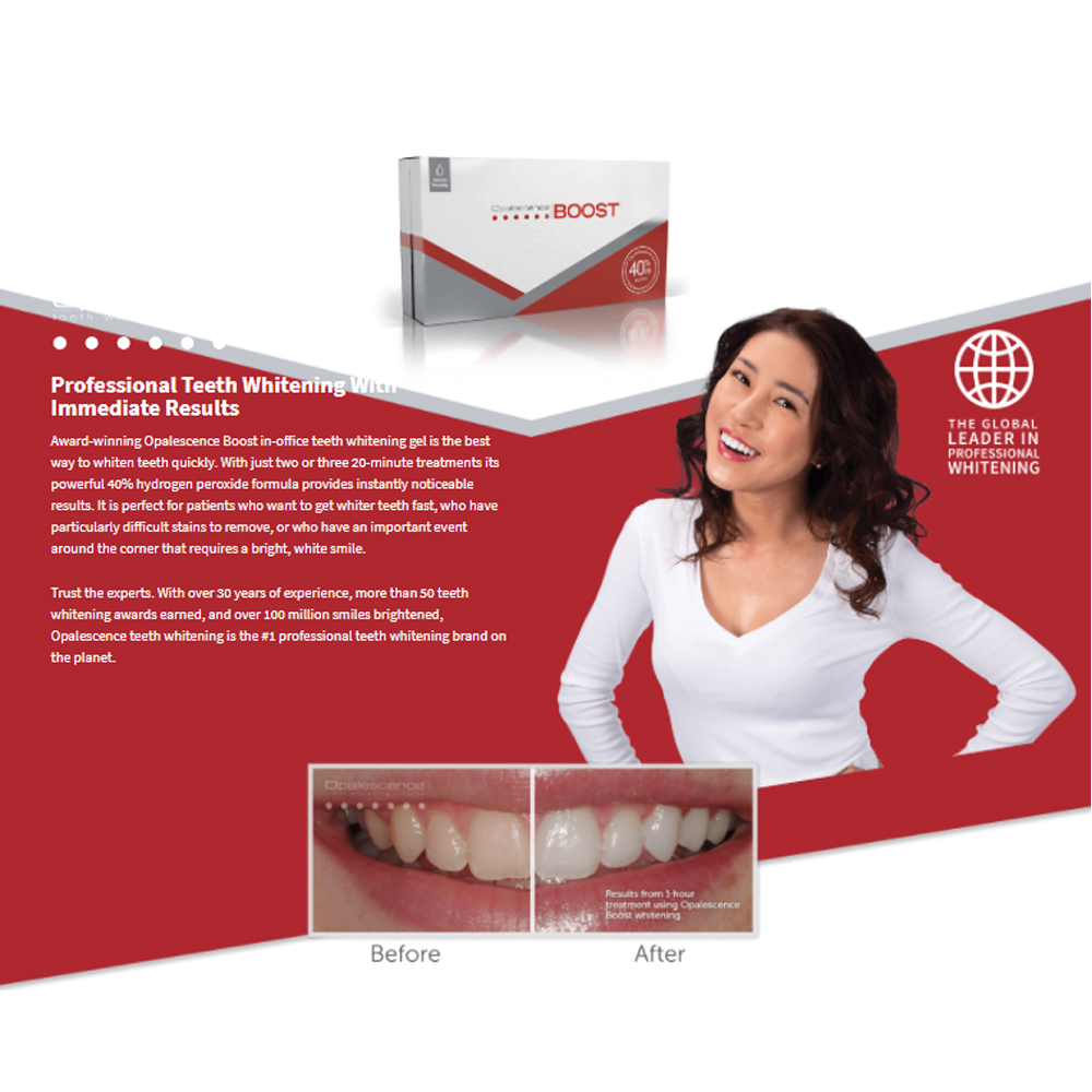 Opalescence Boost 40% PF Ameri – обзор и цена Teeth Whitening Gel Opalescence
