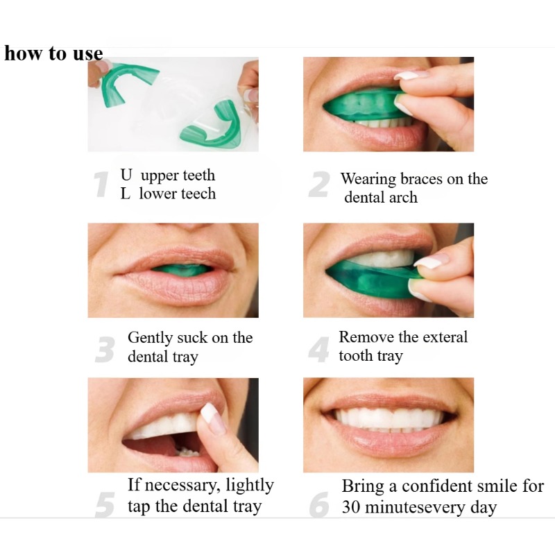 Набор для отбеливания зубов, U – обзор и цена Teeth Whitening For Trays