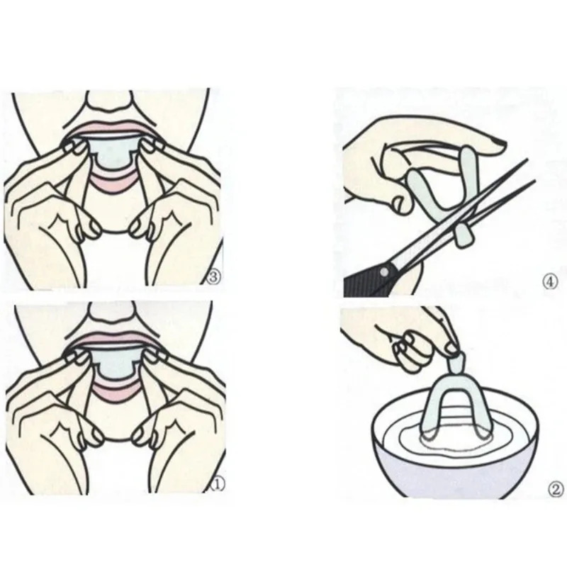 Набор из 1/3/6 пар силиконовых – обзор и цена Teeth Whitening For Trays