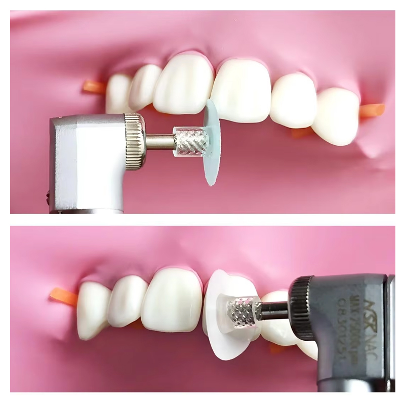 40 шт. стоматологических полир – обзор и цена Teeth Whitening Express