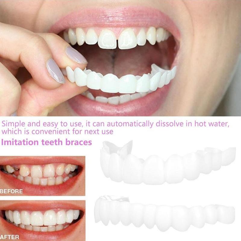 Защелкивающиеся зубы виниры мг – обзор и цена Teeth Whitening Mask