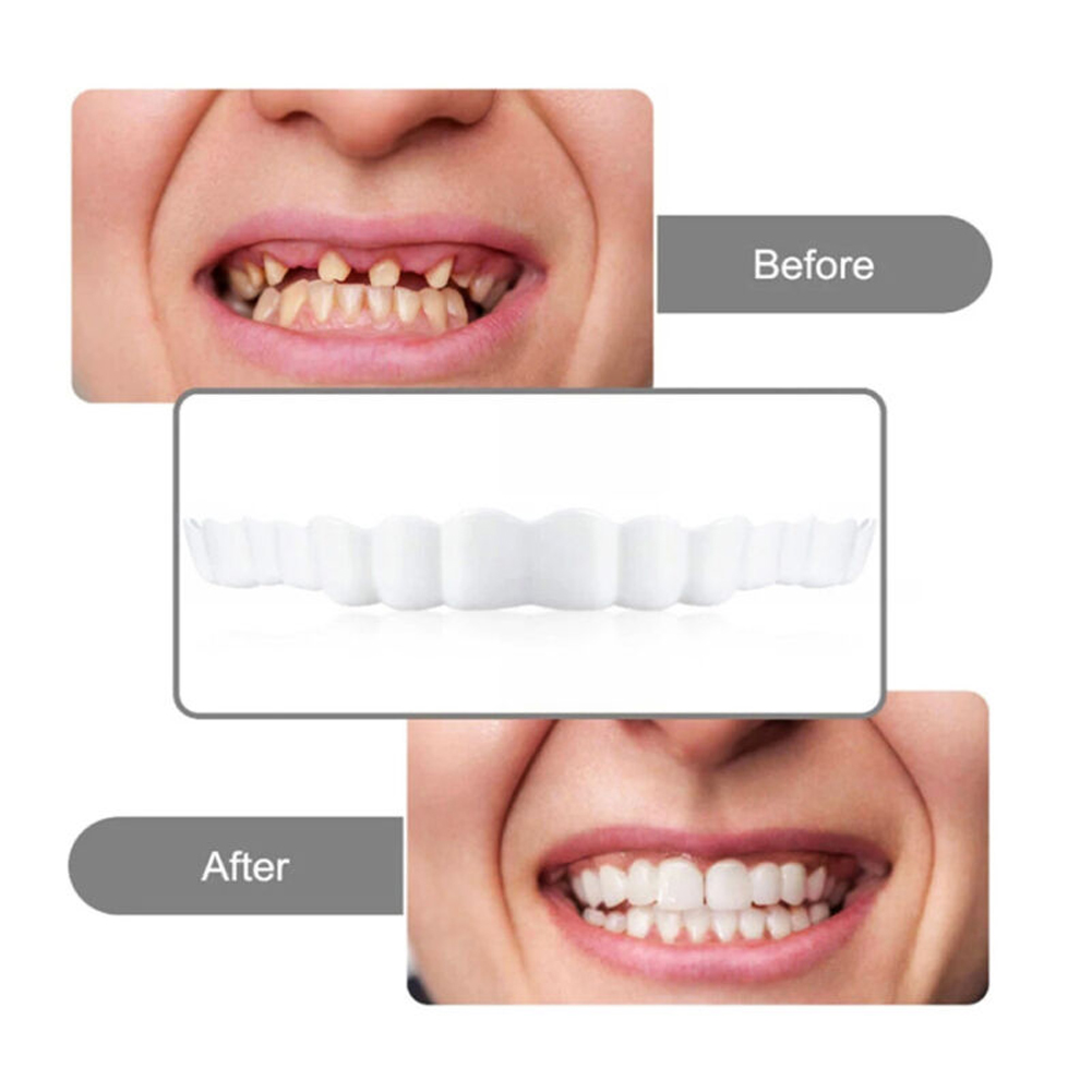 4-6 пар протезов верхней и ниж – обзор и цена Teeth Whitening Mask
