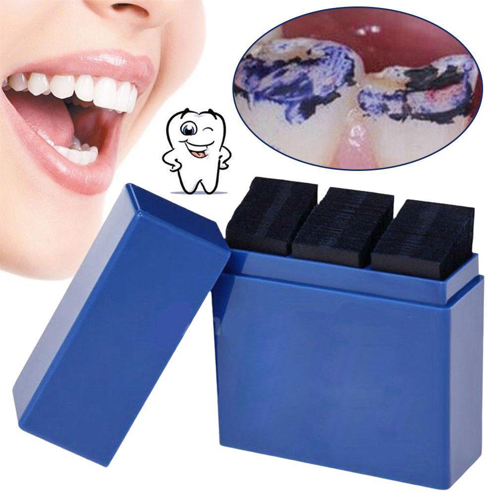 300 листов артикуляционной бум – обзор и цена Teeth Whitening Express