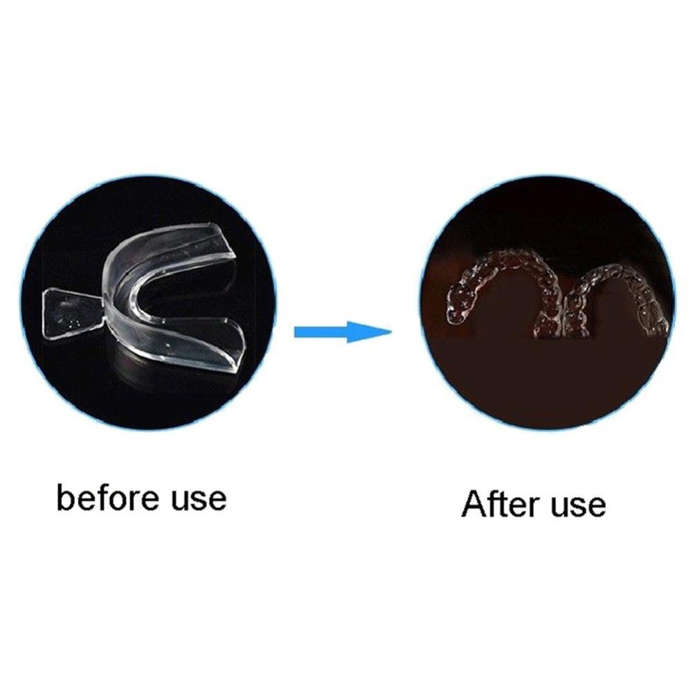 Силиконовая капа-фиксатор для  – обзор и цена Teeth Whitening For Trays