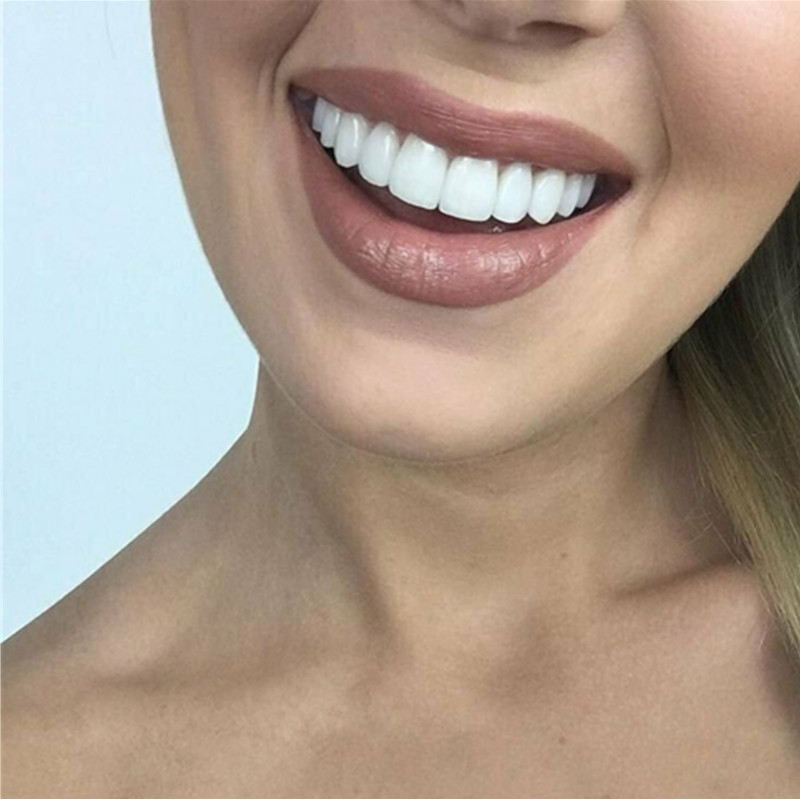 Временные отбеливающие виниры  – обзор и цена Teeth Whitening Mask