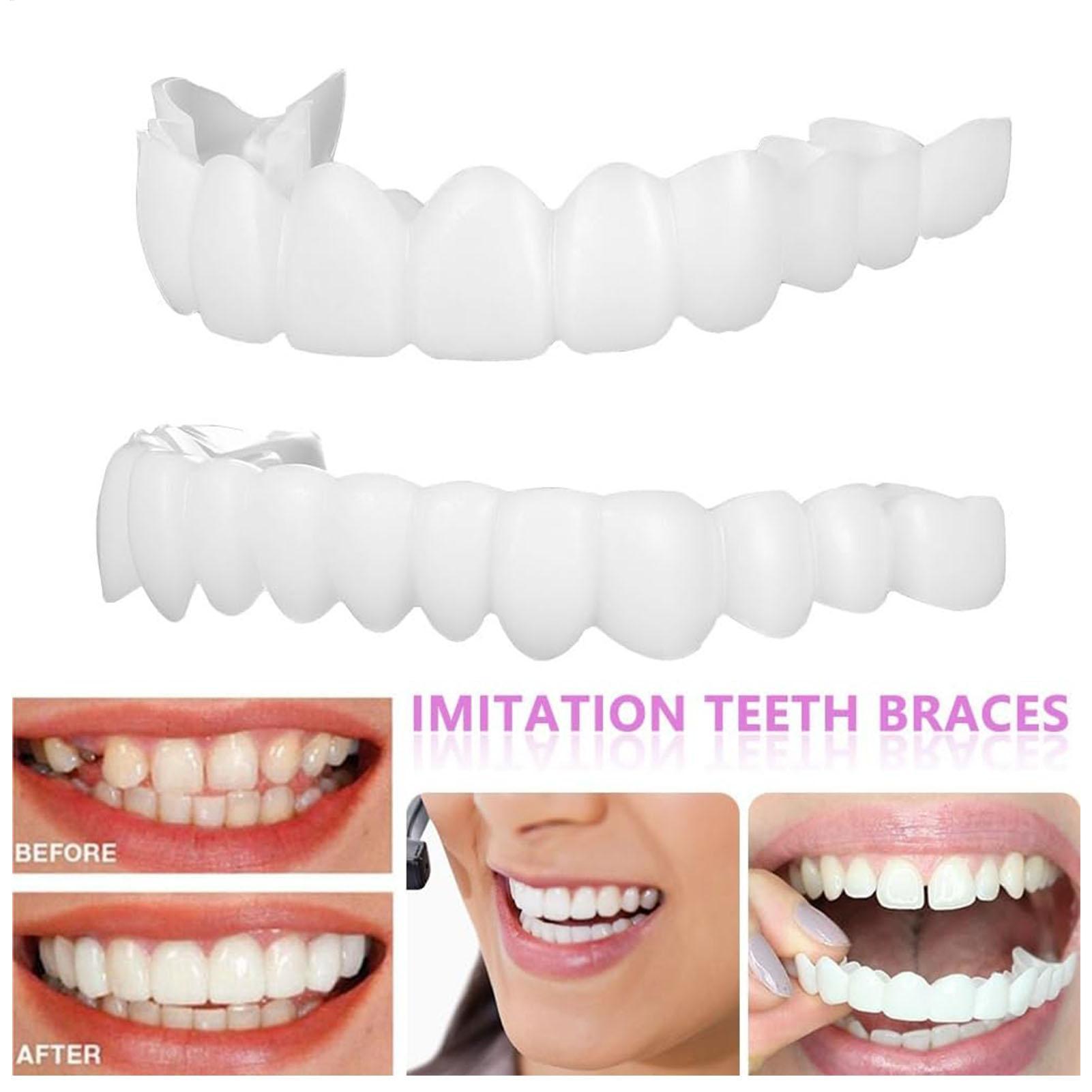 2 шт., виниры для временных зу – обзор и цена Teeth Whitening Mask