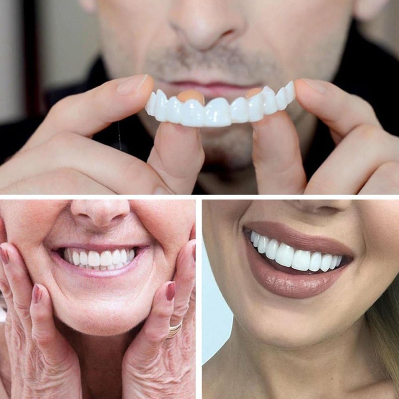 2 шт., виниры для временных зу – обзор и цена Teeth Whitening Mask