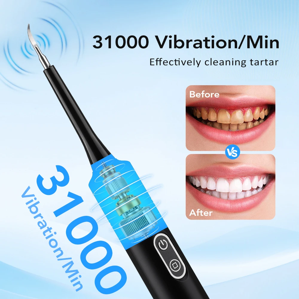 Электрический звуковой вибраци – обзор и цена Teeth Whitening Express